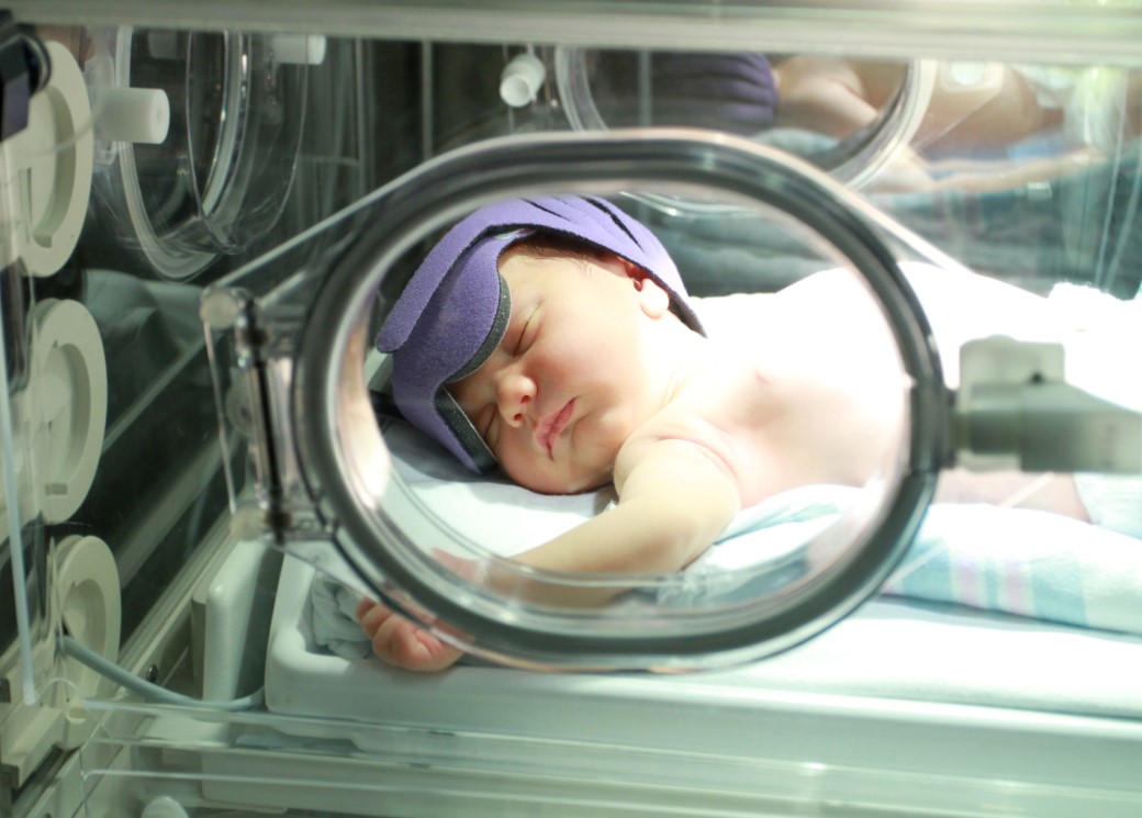 Classification of Physiological jaundice