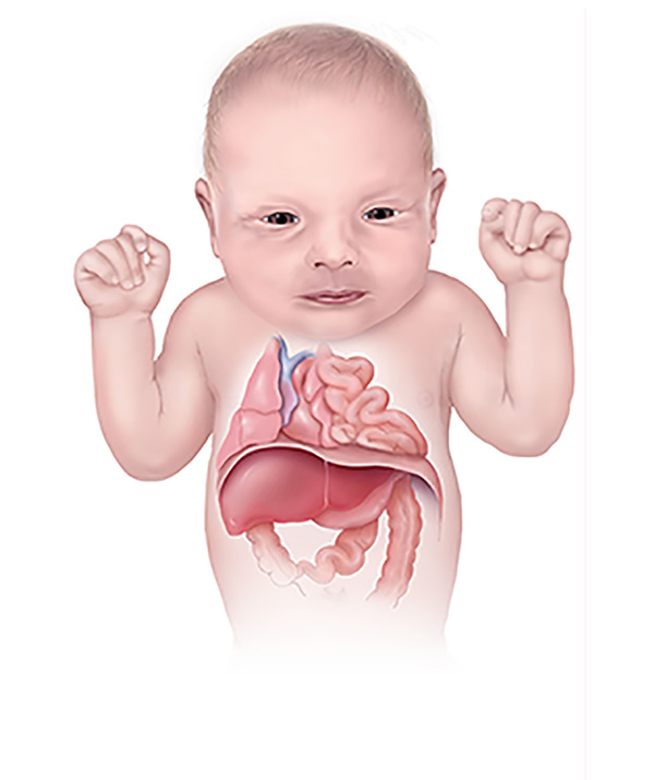Congenital anomalies | CHAPTER 8 | Pediatric Nursing