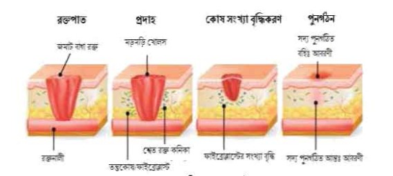 ক্ষতিগ্রস্থ টিস্যু পুনর্গঠনে নিরাময়