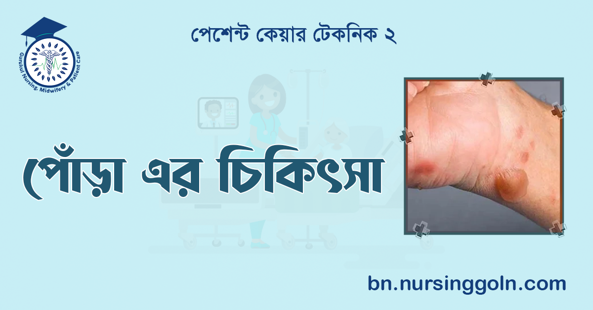 পোঁড়া এর চিকিৎসা