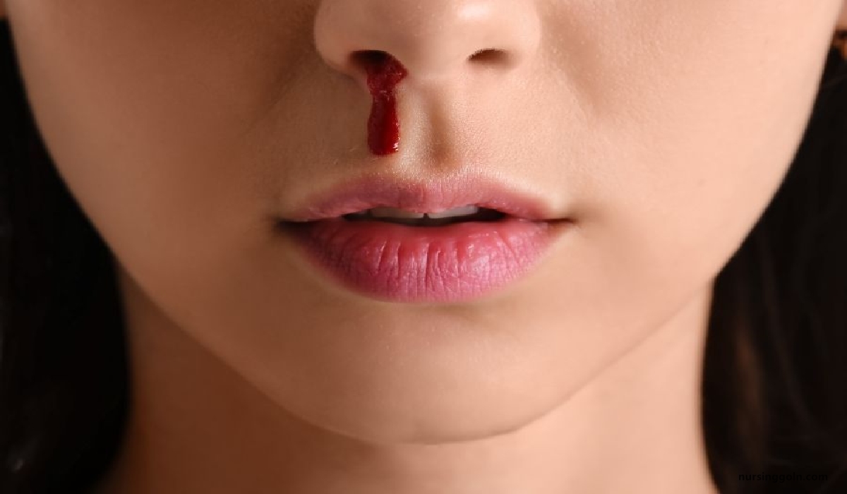 Haemorrhagic Disorder / Bleeding Disorder | CHAPTER-10 | Medical and Surgical Nursing