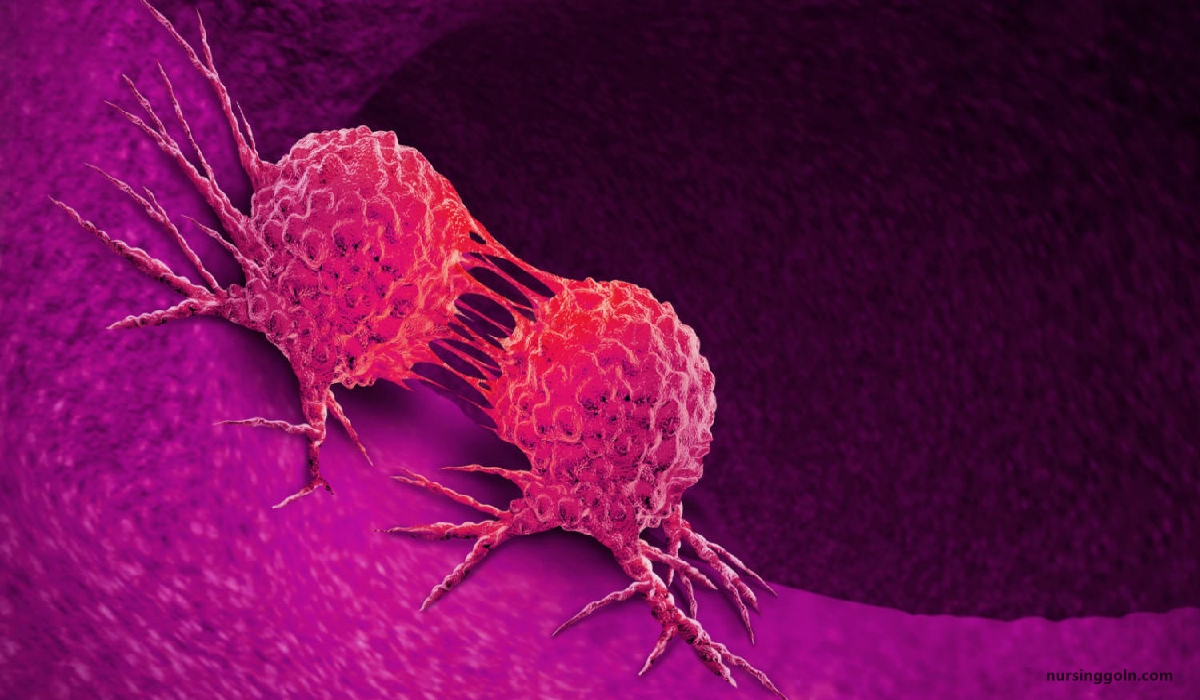 Nursing intervention of cancer | CHAPTER-12 | Medical and Surgical Nursing