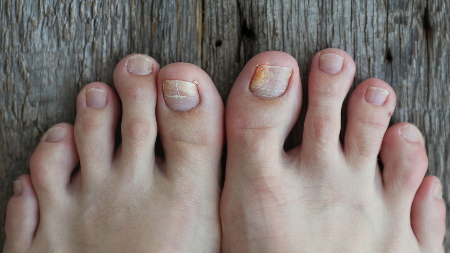 CARE OF FEET 