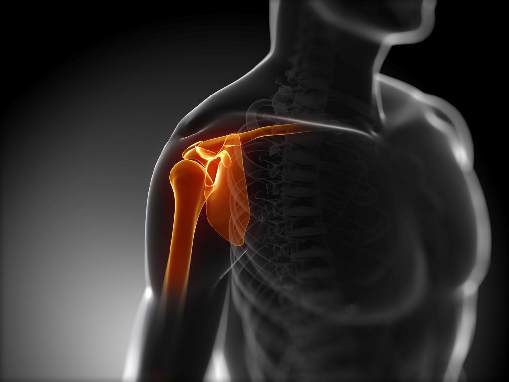 Definition of Dislocation | CHAPTER 6 | Orthopedic Nursing