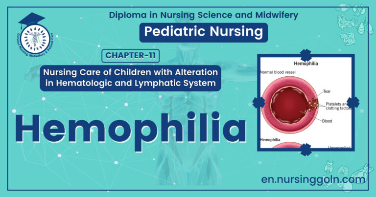 Concept about Hemophilia | CHAPTER 11 | Pediatric Nursing