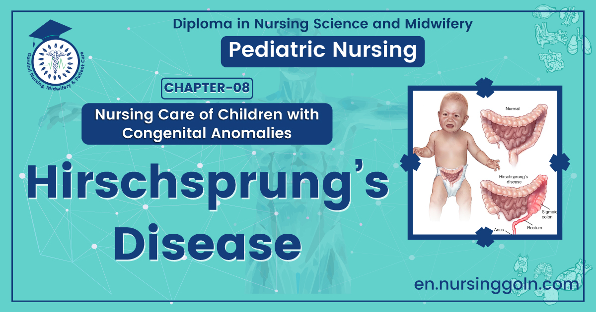 Hirschsprungs disease | CHAPTER 8 | Pediatric Nursing